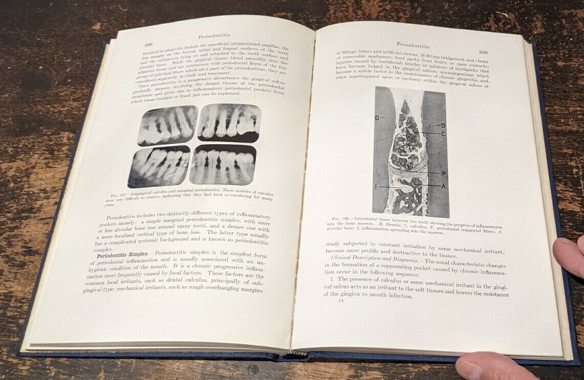 Periodontia, by Edgar D. Coolidge, Maynard K. Hine, Lea & Febiger, 1954-384pages