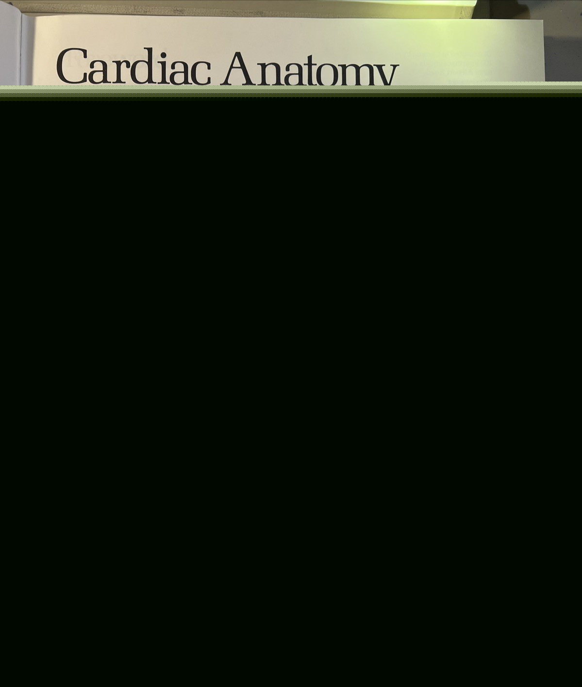 Cardiac Anatomy: An Integrated Text and Color Atlas by Robert Anderson- 1980 -B2