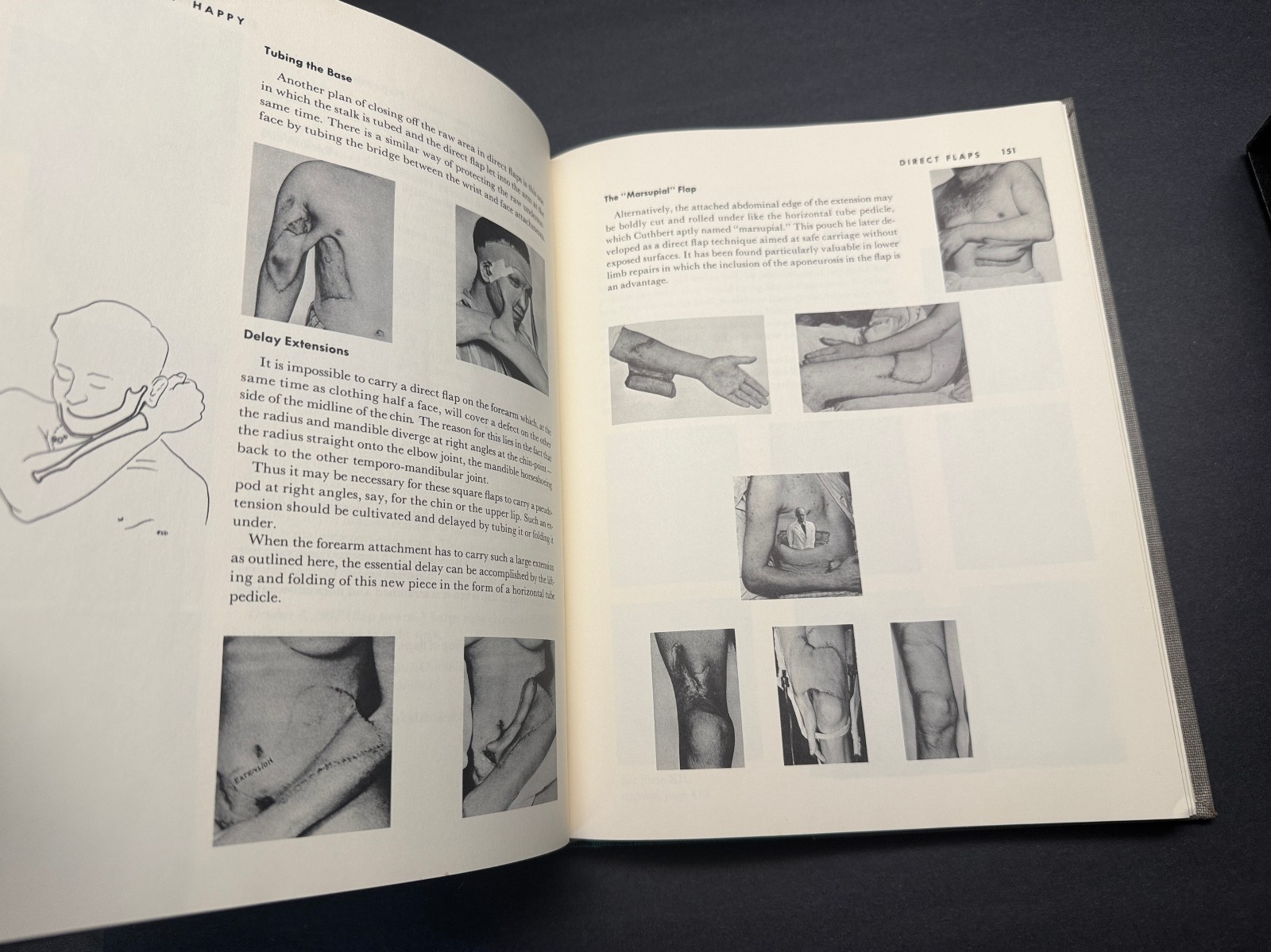 THE PRINCIPLES AND ART OF PLASTIC SURGERY GILLIES & MILLARD 1ST EDITION SLIPCASE
